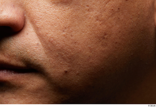 HD Face Skin Max Gaona cheek face nose skin pores…